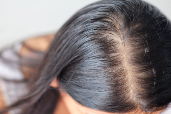 How Biotin Promotes Hair Growth and Prevents Hair Loss