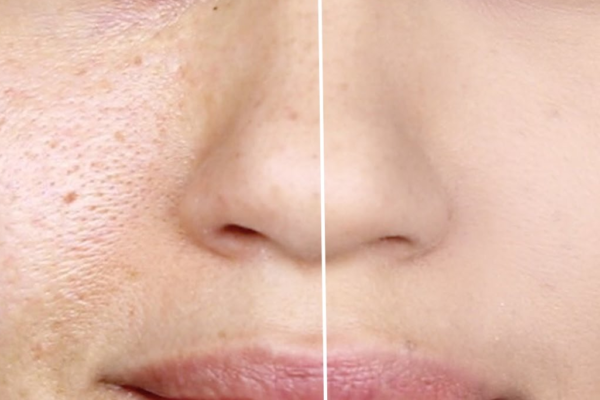 How to make Pores Disappear with Only One Ingredient Naturally