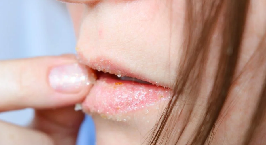 Soft Pink Lips Overnight Remedies