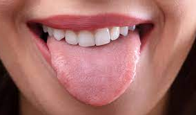 What Your Tongue Indicates About Your Health